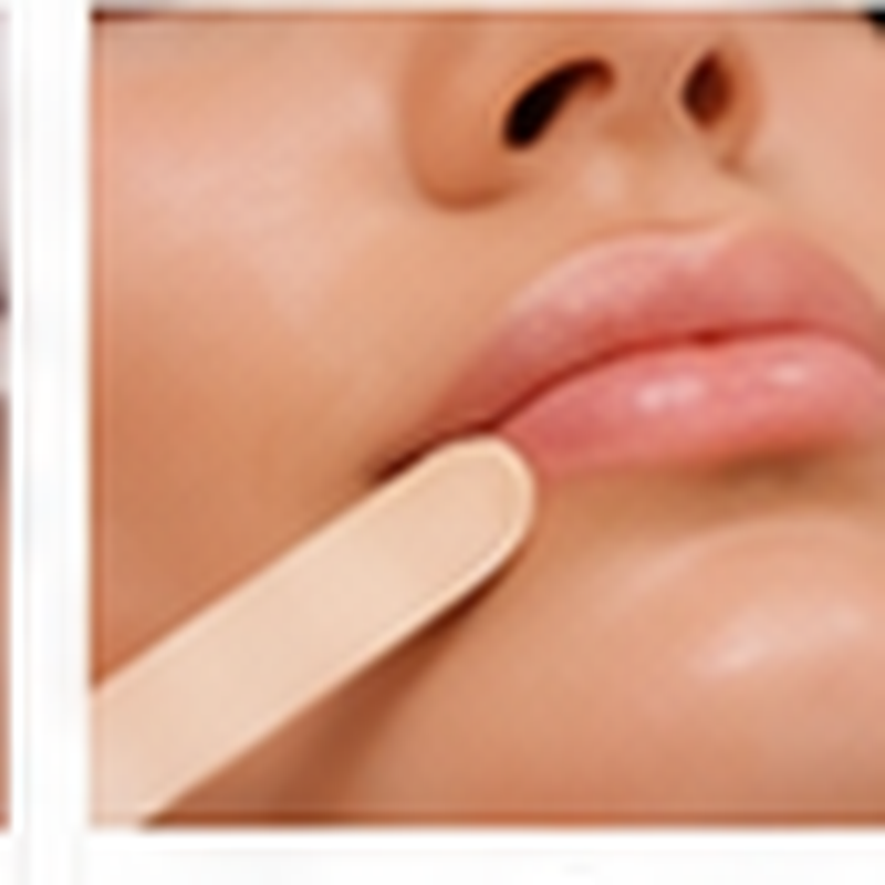 003 labio superior